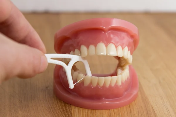 Discover If You Are a Candidate for Overdentures in Hudson NC Through Comprehensive Evaluation and Eligibility Criteria